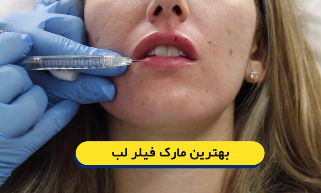 بهترین مارک فیلر لب چیست
