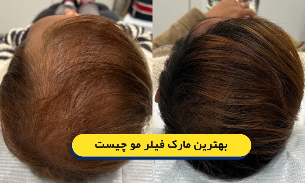 بهترین مارک فیلر مو