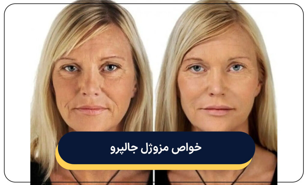 خواص مزوژل جالپرو